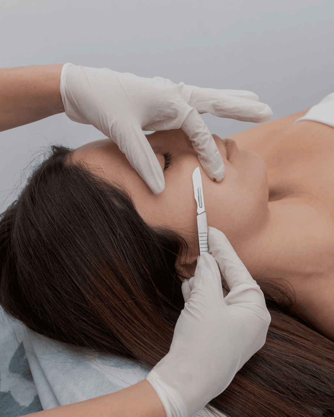 Dermaplaning treatment at Laser & Aesthetic Center