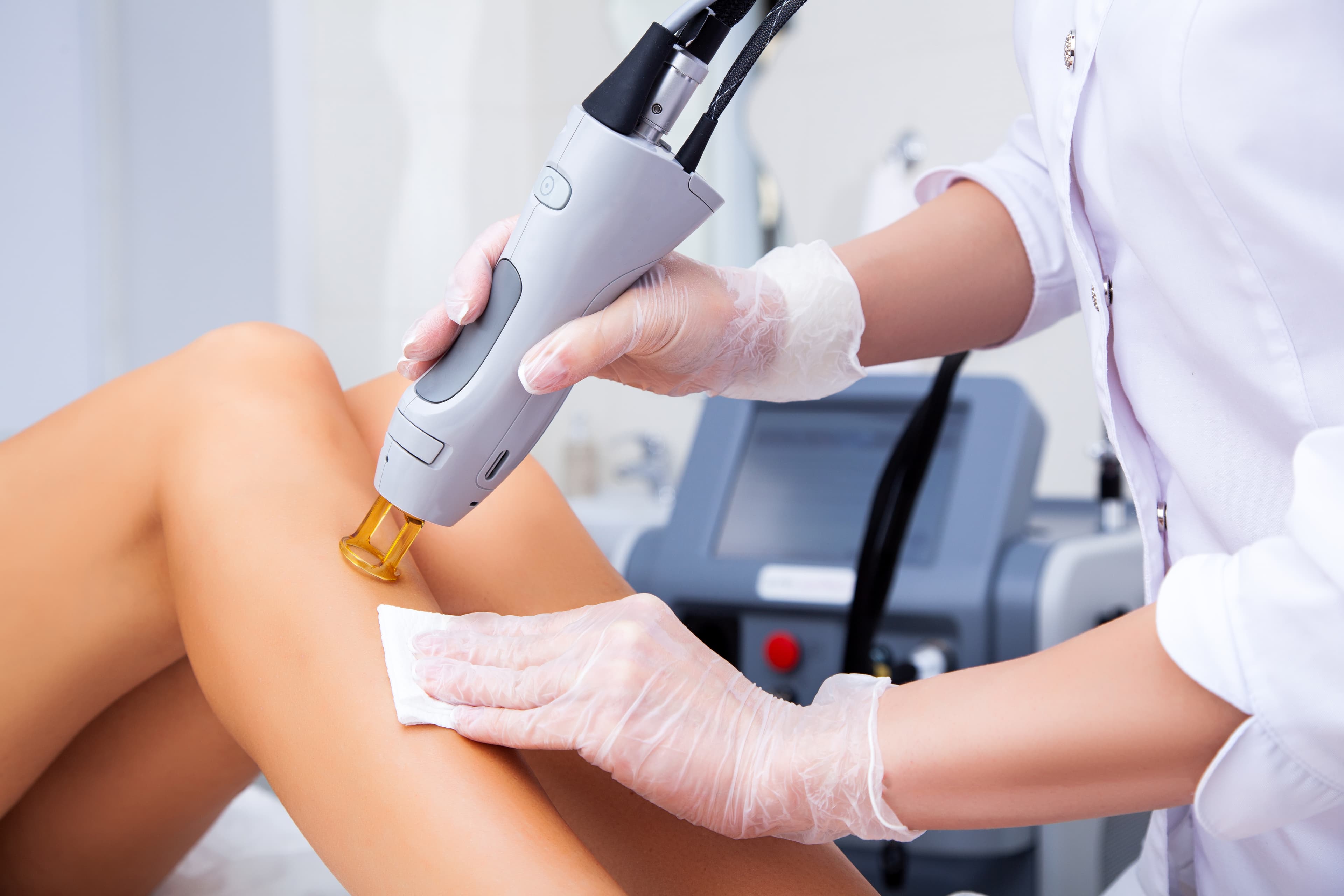 Laser hair removal treatment on leg at Laser & Aesthetic Center